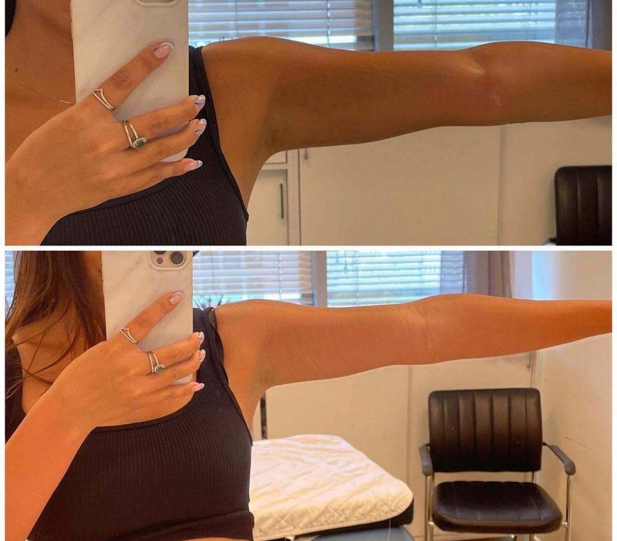   הצהרת היקפים - וולנס ספא