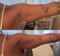  הצהרת היקפים - וולנס קליניק 